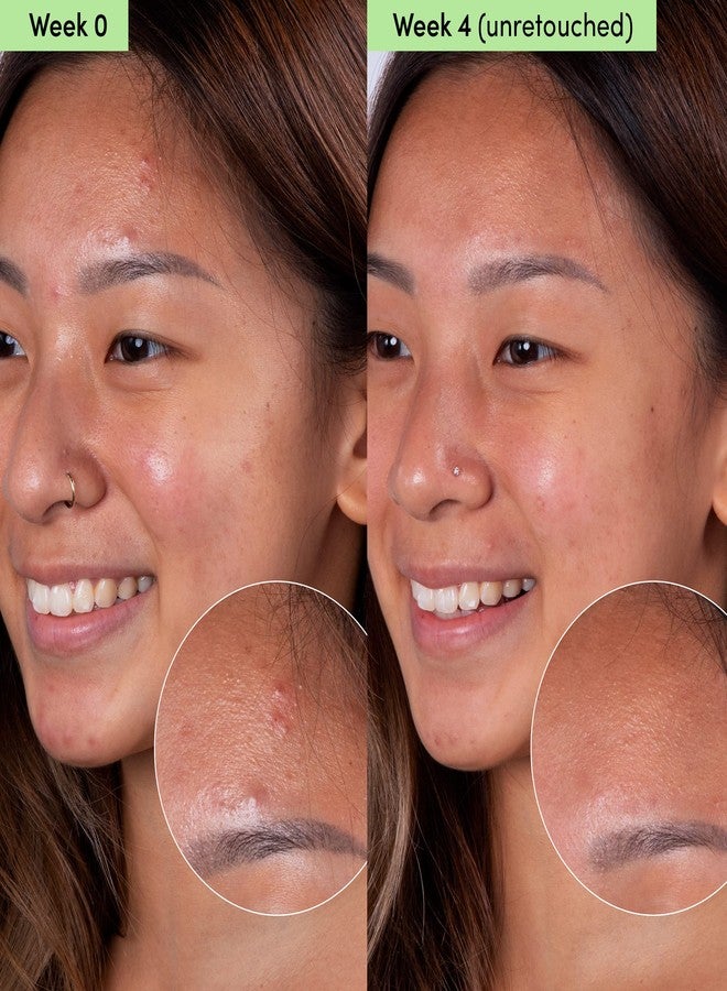 Sand & Sky Oil Control Blemish Clearing Clay Face Mask with Salicylic Acid & Niacinamide - Blemish Fighting Mask, Minimizes Redness, Tightens Pores - Image 5